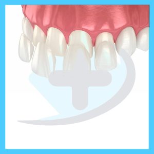 کامپوزیت دندان پزشکی هانا طب تهران