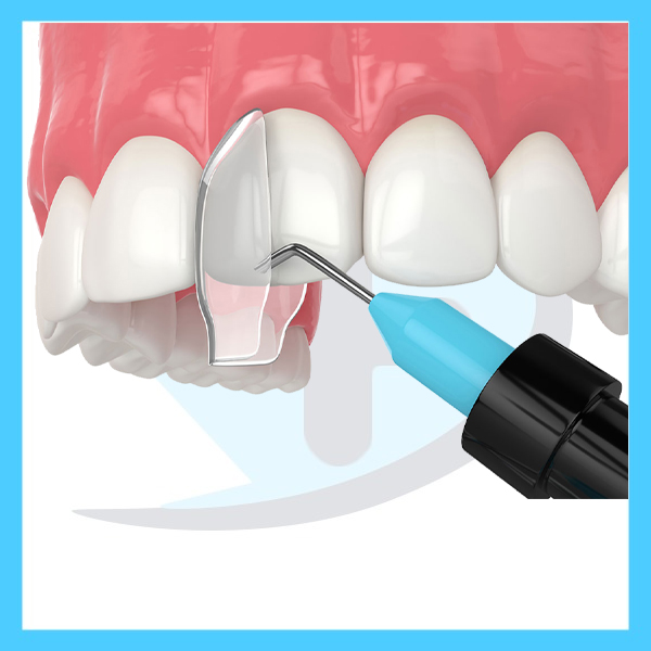 کامپوزیت دندان پزشکی