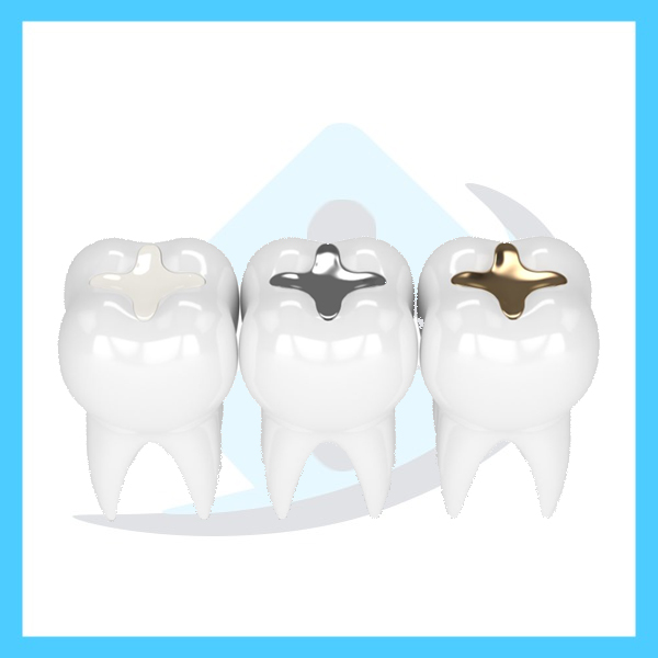 فرق کامپوزیت و آمالگام هانا طب تهران