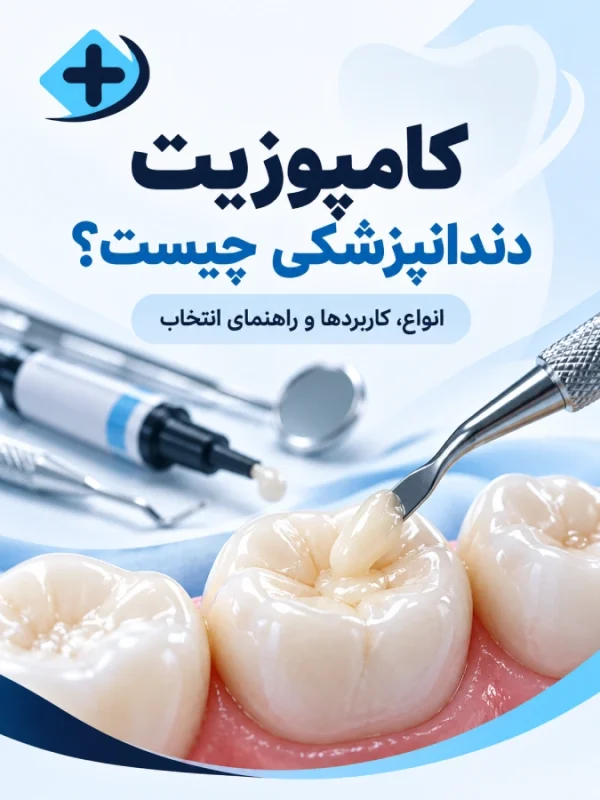کامپوزیت دندانپزشکی چیست؟ انواع، کاربردها و راهنمای انتخاب کامپوزیت دندان